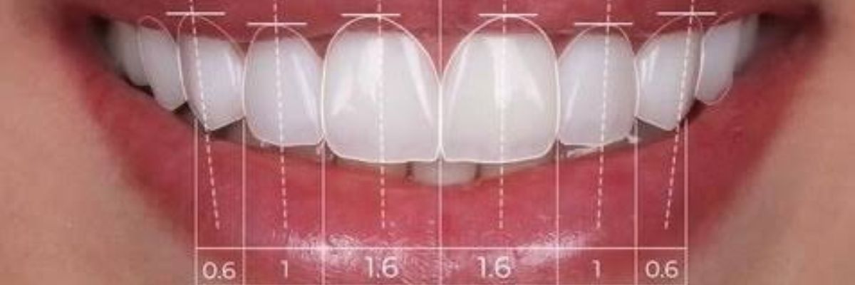 Diseño de sonrisa en OV Dental Studio
