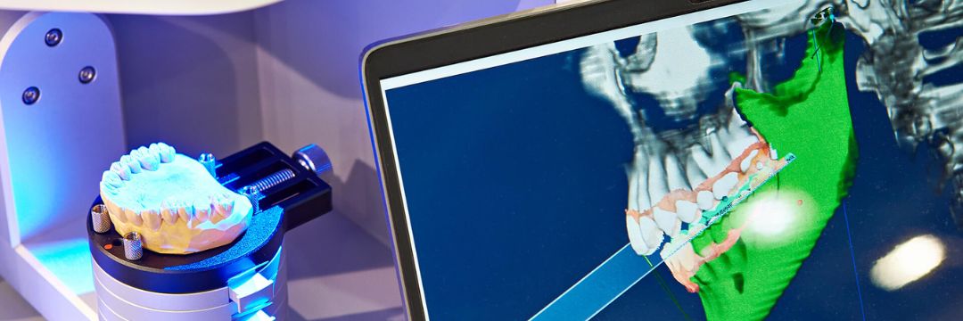 Tecnología y equipos de última generación en OV Dental Studio