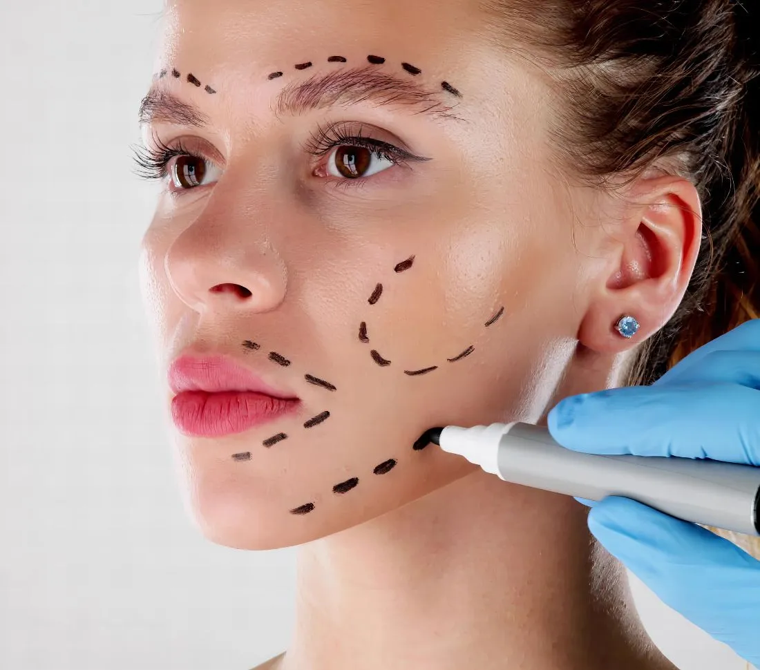 Armonización Orofacial en OV Dental Studio