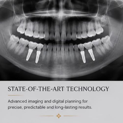 State-of-the-art dental implant technology