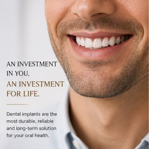 Dental implants: an investment for life