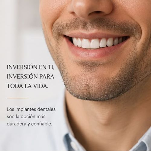 Implantes dentales: una inversión para toda la vida